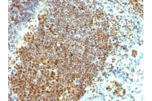 Image no. 2 for anti-Proliferating Cell Nuclear Antigen (PCNA) antibody (ABIN6166296) (PCNA Antikörper)