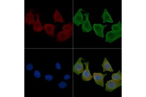 ABIN6260628 and ABIN6276794 staining Hela cells(30 min of UV treatment) by IF/ICC. (CD46 Antikörper  (N-Term))