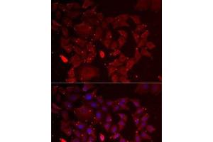 Immunofluorescence analysis of MCF7 cells using ADSS Polyclonal Antibody (ADSS Antikörper)
