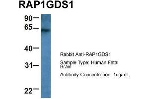 Host: Rabbit  Target Name: RAP1GDS1  Sample Tissue: Human Fetal Brain  Antibody Dilution: 1.