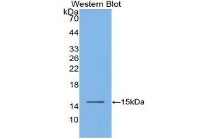 Western blot analysis of the recombinant protein. (Angiotensin I Converting Enzyme 1 Antikörper  (AA 334-409))