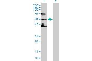 Western Blot analysis of SERPIND1 expression in transfected 293T cell line by SERPIND1 MaxPab polyclonal antibody. (SERPIND1 Antikörper  (AA 1-499))