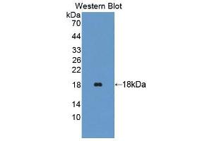 Western blot analysis of the recombinant protein. (TRAPPC2 Antikörper  (AA 1-140))