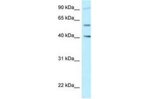 Image no. 1 for anti-SHC SH2-Domain Binding Protein 1-Like (SHCBP1L) (AA 525-574) antibody (ABIN6747880) (SHCBP1L Antikörper  (AA 525-574))