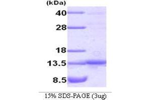 Figure annotation denotes ug of protein loaded and % gel used. (TANK Protein (AA 1-119))