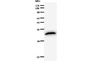 Western Blotting (WB) image for anti-Cyclin T2 (CCNT2) antibody (ABIN930980) (Cyclin T2 Antikörper)