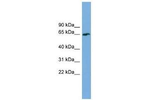 TBC1D24 antibody used at 1 ug/ml to detect target protein. (TBC1D24 Antikörper  (Middle Region))