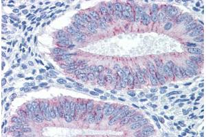 Immunohistochemistry (Formalin-fixed Paraffin-embedded Sections) (IHC (fp)) image for anti-Claudin 1 (CLDN1) (AA 1-212) antibody (ABIN574405)