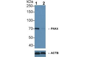 Western blot analysis of (1) Wild-type HeLa cell lysate, and (2) PAK4 knockout HeLa cell lysate, using Rabbit Anti-Human PAK4 Antibody (1 µg/ml) and HRP-conjugated Goat Anti-Rabbit antibody (abx400043, 0.