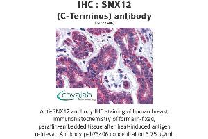 Image no. 2 for anti-Sorting Nexin 12 (SNX12) (C-Term) antibody (ABIN1739487) (SNX12 Antikörper  (C-Term))