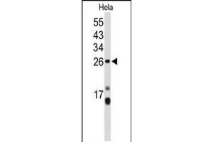 Western blot analysis of CENPH Antibody in Hela cell line lysates (35ug/lane) (CENPH Antikörper  (AA 136-162))