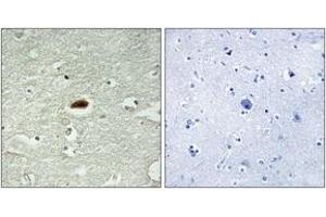 Immunohistochemistry analysis of paraffin-embedded human brain tissue, using Period Circadian Protein 2 (Ab-662) Antibody. (PER2 Antikörper  (AA 636-685))