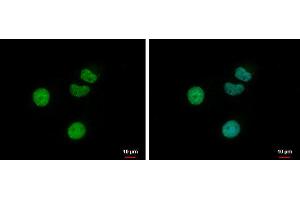 ICC/IF Image Retinoic Acid Receptor gamma antibody detects Retinoic Acid Receptor gamma protein at nucleus by immunofluorescent analysis. (Retinoic Acid Receptor gamma Antikörper)
