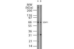 Image no. 1 for anti-SUMO1/sentrin Specific Peptidase 1 (SENP1) (AA 578-590) antibody (ABIN208752) (SENP1 Antikörper  (AA 578-590))