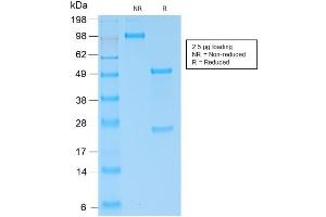 SDS-PAGE Analysis of Purified IgG4 Rabbit Recombinant Monoclonal Antibody ABIN6383885. (Rekombinanter IGHG4 Antikörper)