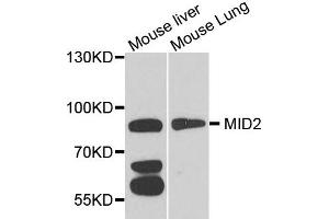 Western blot analysis of extract of mouse liver and mouse lung cells, using MID2 antibody.
