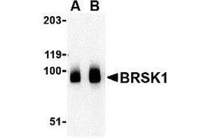 Western blot analysis of BRSK1 in human brain tissue lysate with AP30166PU-N BRSK1 antibody at (A) 0. (BRSK1 Antikörper  (C-Term))