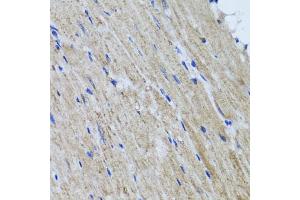 Immunohistochemistry of paraffin-embedded mouse heart using HYAL1 antibody (ABIN5975045) at dilution of 1/100 (40x lens). (HYAL1 Antikörper)