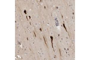 Immunohistochemical staining of human cerebral cortex with RAB11FIP3 polyclonal antibody  shows strong cytoplasmic and nuclear positivity in neuronal cells. (RAB11FIP3 Antikörper)