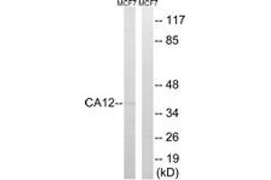 Western blot analysis of extracts from MCF-7 cells, using CA12 Antibody. (CA12 Antikörper  (AA 231-280))