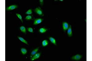 Immunofluorescence staining of Hela cells cells with ABIN7144990 at 1:200, counter-stained with DAPI. (DDX42 Antikörper  (AA 519-819))