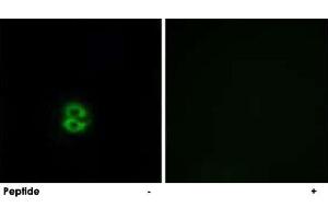 Immunofluorescence analysis of A-549 cells, using CHST6 polyclonal antibody . (CHST6 Antikörper)
