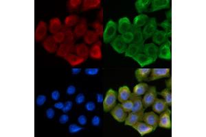ABIN6262627 and ABIN6268688 staining Hela cells(30 min of UV treatment) by IF/ICC. (IL-4 Antikörper  (Internal Region))