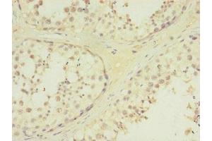 Immunohistochemistry of paraffin-embedded human testis tissue using ABIN7172730 at dilution of 1:100 (MTERFD3 Antikörper  (AA 1-250))