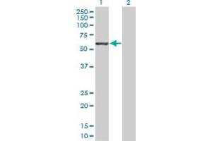 Western Blot analysis of GRB10 expression in transfected 293T cell line by GRB10 MaxPab polyclonal antibody. (GRB10 Antikörper  (AA 1-536))