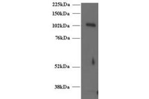 ABIN185243 (2µg/ml) staining of Human T-lymphocyte lysate (35µg protein in RIPA buffer).