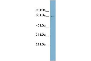 WB Suggested Anti-ZNF18 Antibody Titration:  0. (ZNF18 Antikörper  (Middle Region))