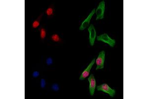 ABIN7094711 and ABIN7098762 staining Hela cells by IF/ICC. (Histone H1.5 Antikörper  (N-Term))