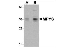 Western blot analysis of MPYS in A-20 cell lysate with AP30565PU-N MPYS antibody at 1 µg/ml (A) and 2 μg/ml (B).