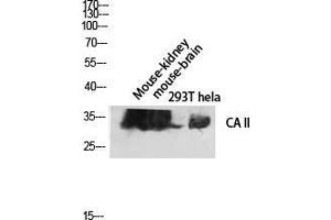 Western Blot (WB) analysis of Mouse Kidney Mouse Brain 293T HeLa lysis using CA II antibody. (CA2 Antikörper  (C-Term))