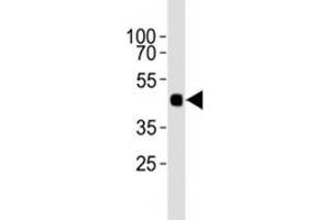 Western blot analysis of lysate from 12 tagged recombinant protein cell lines using HA antibody diluted at 1:1000. (HA-Tag Antikörper)