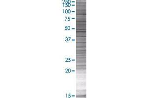 LTBR transfected lysate. (LTBR 293T Cell Transient Overexpression Lysate(Denatured))
