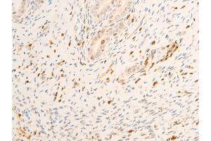 Immunohistochemistry (IHC) image for anti-Janus Kinase 1 (JAK1) (pTyr1022), (pTyr1023) antibody (ABIN6255762)