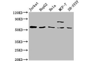Western Blot Positive WB detected in: Jurkat whole cell lysate, HepG2 whole cell lysate, Hela whole cell lysate, MCF-7 whole cell lysate, SH-SY5Y whole cell lysate All lanes: SLC37A2 antibody at 1:2000 Secondary Goat polyclonal to rabbit IgG at 1/50000 dilution Predicted band size: 55, 43, 14 kDa Observed band size: 55 kDa (SLC37A2 Antikörper  (AA 46-84))