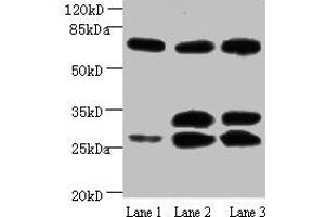 Western blot All lanes: Amyloid beta A4 antibody at 1 μg/mL Lane 1: Mouse heart tissue Lane 2: Mouse kidney tissue Lane 3: Mouse lung tissue Secondary Goat polyclonal to Mouse IgG at 1/15000 dilution Predicted band size: 30, 35, 72, 80 kDa Observed band size: 30, 35, 72 kDa (APP Antikörper)