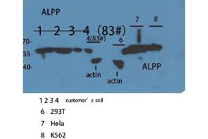 Western Blot (WB) analysis of sample using ALPP/ALPPL2 Polyclonal Antibody. (PLAP Antikörper  (N-Term))