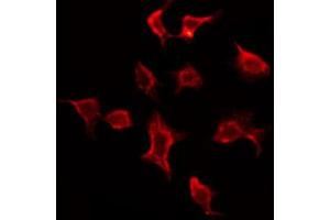 ABIN6273842 staining Hela by IF/ICC. (CMKLR1 Antikörper  (Internal Region))