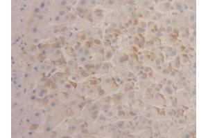 DAB staining on IHC-P; Samples: Human Liver Tissue (IFNA4 Antikörper  (AA 10-163))