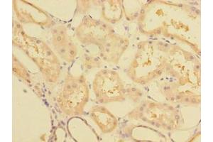 Immunohistochemistry of paraffin-embedded human kidney tissue using ABIN7148068 at dilution of 1:100 (CCDC112 Antikörper  (AA 201-446))