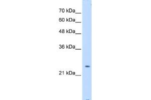 Western Blotting (WB) image for anti-Protein tyrosine Phosphatase, Non-Receptor Type 2 (PTPN2) (Middle Region) antibody (ABIN2782195)