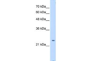 WB Suggested Anti-PTPN2 Antibody Titration:  0. (PTPN2 Antikörper  (Middle Region))