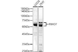 Western blot analysis of extracts of various cell lines, using FBXO7 antibody (ABIN6130383, ABIN6140527, ABIN6140528 and ABIN6223349) at 1:500 dilution. (FBXO7 Antikörper  (AA 353-522))