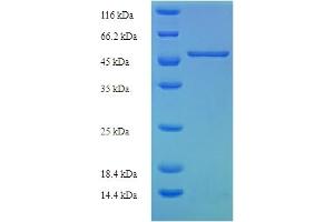 SLC25A30 Protein (AA 1-291, full length) (His-SUMO Tag)