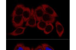 Confocal immunofluorescence analysis of HeLa cells using RPL23 Polyclonal Antibody at dilution of 1:200. (RPL23 Antikörper)