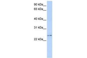 RCAN3 Antikörper  (C-Term)