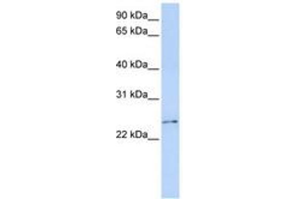 RCAN3 Antikörper  (C-Term)